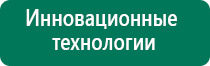 Аппараты стл 2016